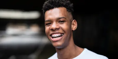 CM-voordeel: Orthodontie